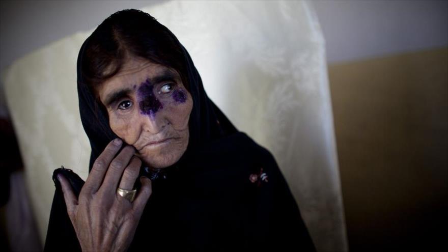 PELIGROSA ENFERMEDAD SE EXTIENDE DESDE SIRIA A ORIENTE MEDIO Y EUROPA CON EL FLUJO DE&nbsp;REFUGIADOS